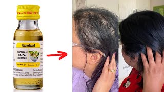 Hamdard Roghan Baiza Murgh Oil Review in Hindi [upl. by Leahciam]