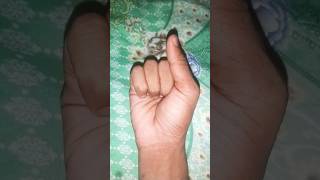 Four fingers 😰😰viral shorts short 200k [upl. by Eedolem]