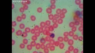 AmScope T690CPL Blood Sample Test [upl. by Dnalsor]