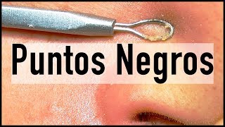 CÓMO QUITAR PUNTOS NEGROS  EN UN DÍA FUNCIONA CARA NARIZ LABIOS ESPALDA [upl. by Leggett]