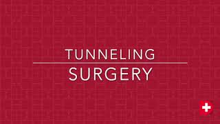 Tunneling flap technique  Dental Microsurgery [upl. by Aniretac]