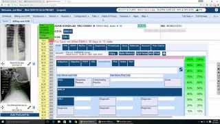 ClinicMind ICD 10 System Overview for Psychologists [upl. by Alexei]