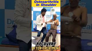 Osteoarthritis Recovery After Treatment ad ytviral treatment colors [upl. by Ahseki]