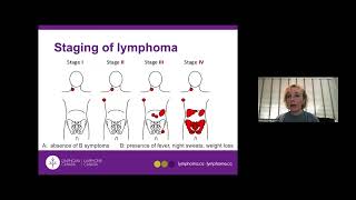 Day 2  Lymphoma Subtypes and Therapies  4 [upl. by Ellenoj]