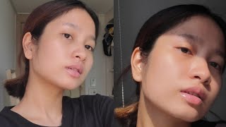 Korean skincare routine that FINALLY WORKS for my acneprone skin [upl. by Aisad]