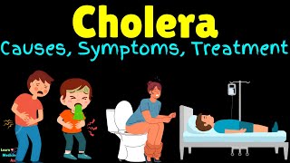 Cholera – Symptoms Causes Pathogenesis Diagnosis Treatment Complications Prevention amp Vaccine [upl. by Nivla424]