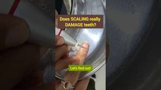 Scaling Damages Teeth Dr Srishti Bhatia scaling teethcleaning smile [upl. by Digirb]