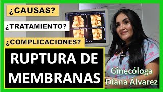 RUPTURA DE MEMBRANAS POR GINECOLOGA DIANA ALVAREZ [upl. by Yelkreb]