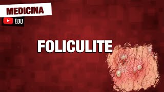 Foliculite bactéria causadora patologia e tratamento [upl. by Wayne]