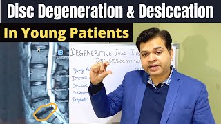 Disc Degeneration L5 S1 Disc Desiccation Disc Degeneration Causes DDDDegenerative Disc Treatment [upl. by Skolnik]