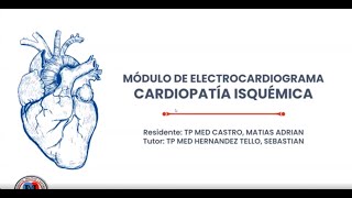 Electrocardiograma en cardiopatía isquémica [upl. by Nivanod232]