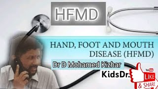 HFMD  Hand Foot Mouth Disease in Children தமிழ் DrMohamed kizhar HFMD [upl. by Jania]