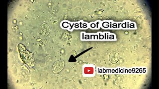 Cysts of Giardia lamblia  Parasitology  labmedicine9265 nohamadboulytahadoodaianew2185 [upl. by Dnomyar]