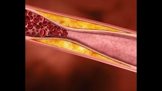 Vijf gezonde voedselsoorten die je cholesterol verlagen [upl. by Maril834]