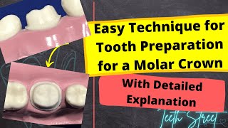 Easy Technique for Tooth Preparation with Detailed Explanation  Lower Molar No background music [upl. by Emearg]