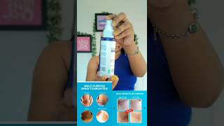 Dermdoc 5 Underarms Treatment Review trendingonshorts shorts [upl. by Burhans]