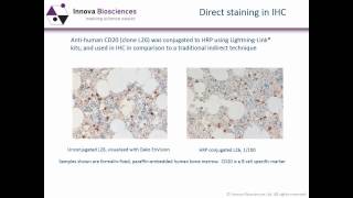 Immunohistochemistry Webinar An Introduction to Immunohistochemistry [upl. by Novad]