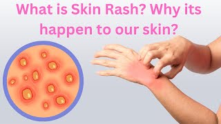 What is Skin Rash Why its happen to our skin  Med About You [upl. by Fulton]