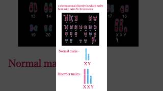 Klinefilter syndrome  Symptoms chromosomal disorderXXY male chromosomes shorts klinefelter [upl. by Assena23]