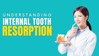 Understanding Internal Tooth Resorption Causes Symptoms and Treatment [upl. by Oecam]