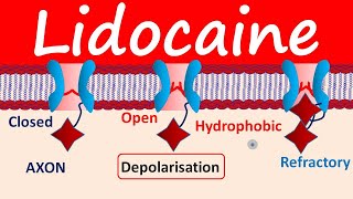 Lidocaine as Local Anesthetic [upl. by Aissirac]