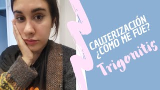 TRIGONITIS  Cauterización de vejiga mi experiencia [upl. by Nurse]