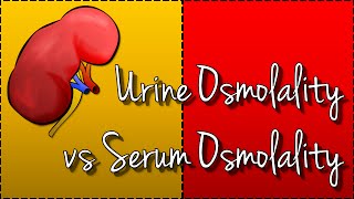 Urine Osmolality vs Serum Osmolality Hyponatraemia [upl. by Akinek]