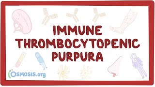 Immune thrombocytopenic purpura  an Osmosis Preview [upl. by Bubalo516]