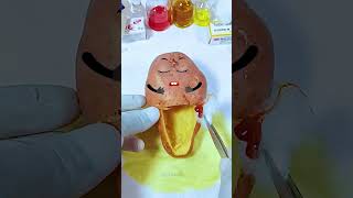 Potato has a baby Need Emergency Surgery jidoodle fruitsurgery foodsurgery [upl. by Dumm]