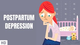 Postpartum Depression Part2 [upl. by Ingold]