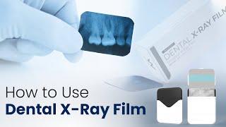 How to use Dental XRay Film  Waldent Dental XRay Film IOPA [upl. by Till]