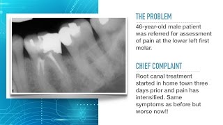 Advances in Endodontic Treatment Part 1Diagnosis and Treatment Planning [upl. by Raine]