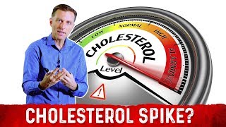 Intermittent Fasting and Ketosis May Spike Your Cholesterol – Dr Berg [upl. by Siekram422]