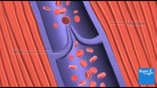 How deep vein thrombosis DVT forms  Bupa Health [upl. by German]