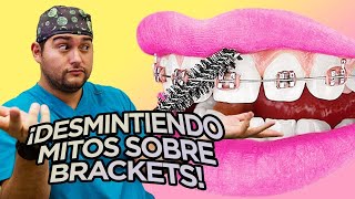 ¿HASTA QUE EDAD SE PUEDEN PONER BRACKETS ¡14 MITOS DESMENTIDOS DE LA ORTODONCIA en tus DIENTES [upl. by Azitram]