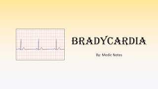 Bradycardia  causes mechanism and pathophysiology sign value [upl. by Annaik]