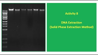 Activity 8 DNA Extraction Solid Phase Extraction Method [upl. by Annerb602]