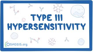 Type III hypersensitivity immune complex mediated  causes symptoms amp pathology [upl. by Tengler]