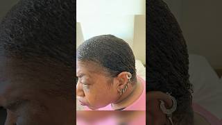 Before and After Hair Growth Results howtogrowyourhairfaster [upl. by Arraeic]