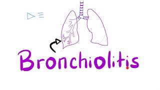 Acute Bronchiolitis Bronchiolitis ObliteransOrganizing Pneumonia BOOP  Pulmonology [upl. by Iseabal]