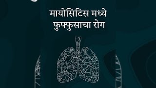 मायोसिटीस मध्ये फुफ्फुसचा रोग Pulmonary disease in myosistis [upl. by Karlens]