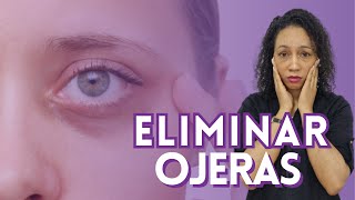 Como ELIMINAR LAS OJERAS  Tratamientos que sí funcionan  MÉDICA explica [upl. by Eisnil947]