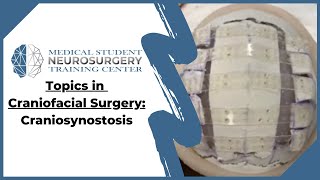 Topics in Craniofacial Surgery Craniosynostosis [upl. by Ikcim]