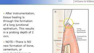 Nonsurgical Periodontal Therapy NSPT  Perio Ch 24 Lect I [upl. by Draw731]