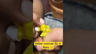 Yellow cannula fix in baby 👶  cannula cannulation trending shorts new SMpharmacy [upl. by Adiam771]