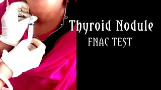 FNAC In The Diagnosis of Thyroid Nodule।। [upl. by Flessel]