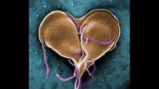 Infectious Disease InfoVid  Giardia [upl. by Scammon]