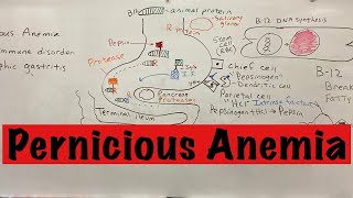 Pernicious Anemia A Simple Explanation [upl. by Paviour]