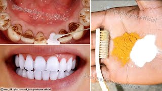 Secret that Dentists dont want you to know Remove Tartar and Teeth Whitening in just 2 minutes [upl. by Nojram632]