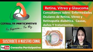 Patologías Oculares de Retina Vitreo y Retinopatía diabética Causas y Daños Consulta P 121124 [upl. by Oeniri]